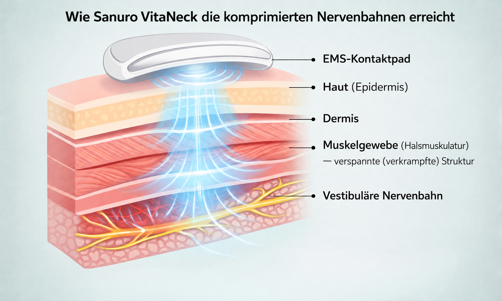 Wie VitaNeck die komprimierten Nervenbahnen erreicht